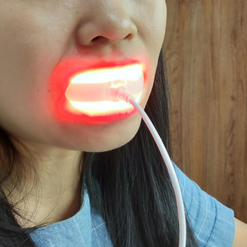 Clinic Red Laser Oral Therapy  - Healing Wellness recensie en prijs